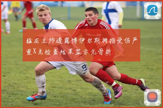 猛龙主帅透露博伊尔斯拇指受伤严重X光检查结果显示无骨折